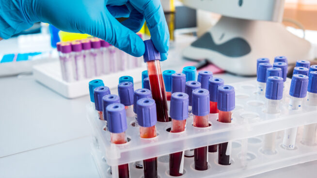 A lab technician's gloved hand placing vials with blood in a test tube holder.